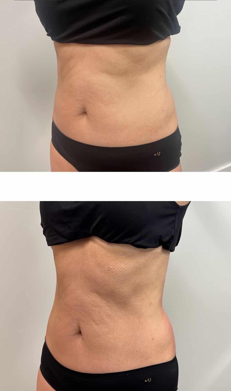 Before and After Image: T-Shape 2 - left-front-oblique