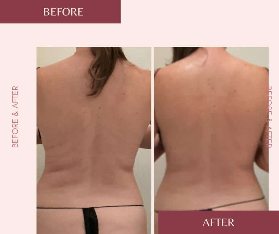 Before and After Image: T-Shape 2 - back
