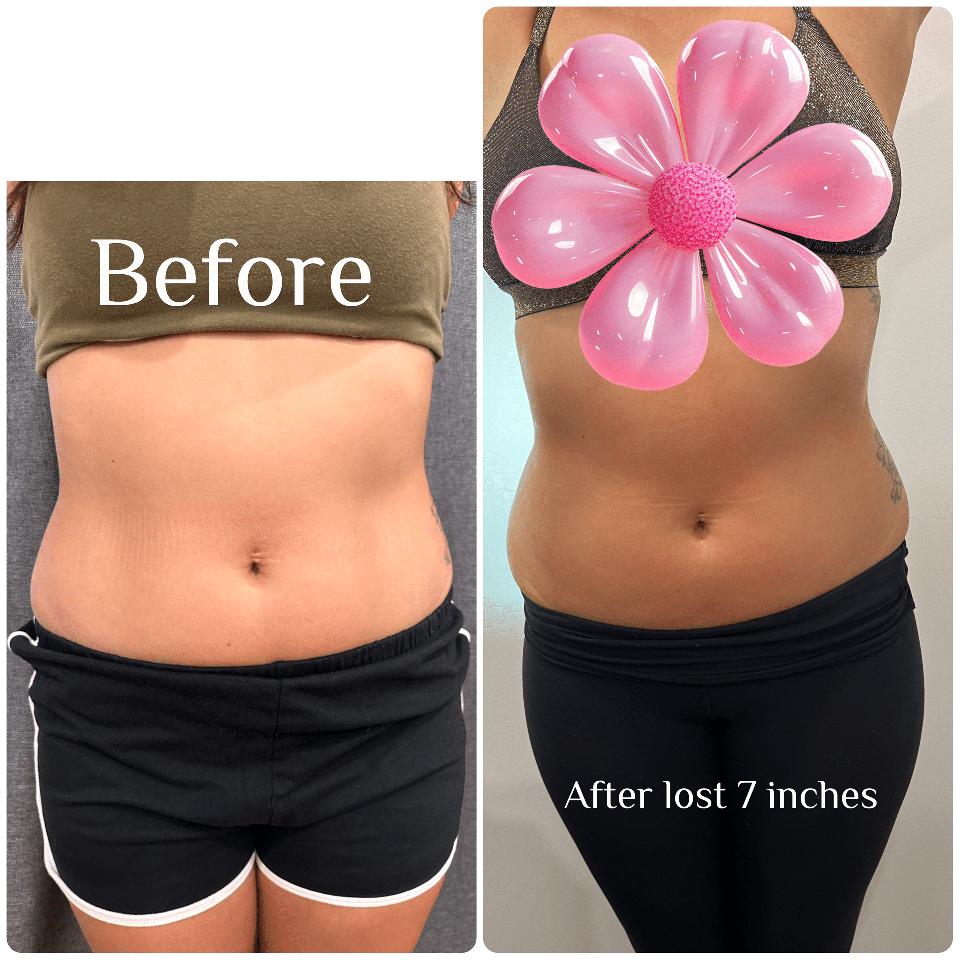 Before and After Image: T-Shape 2 - front