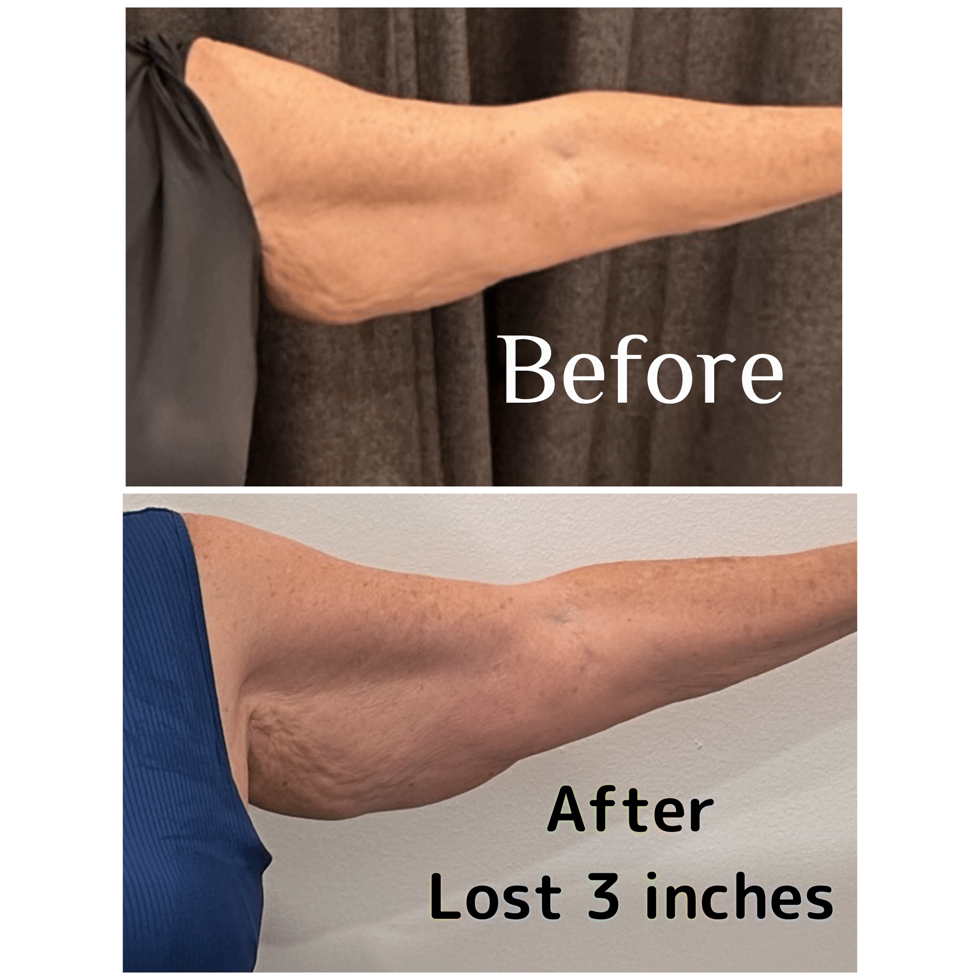 Before and After Image: T-Shape 2 - front